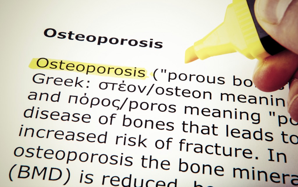 Osteoporosis – Ways to Avoid the ‘Silent Disease’