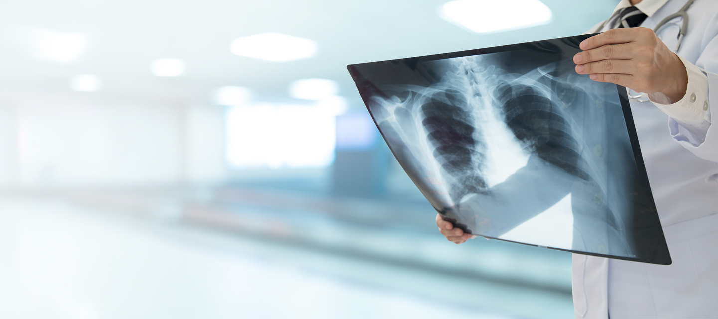 Radiology second opinion service